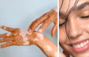 Dr. Daniela Uribe Holmgren spricht über den Zusammenhang zwischen Haut und Psyche in ihrer Kolumne „Haut und Herz gehören zusammen“.